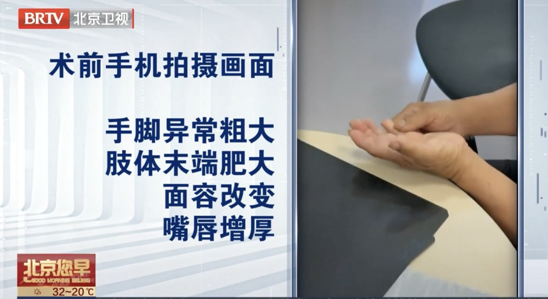 血压血糖飙升？可能得了这种肿瘤！“不治疗，寿命缩短10年”