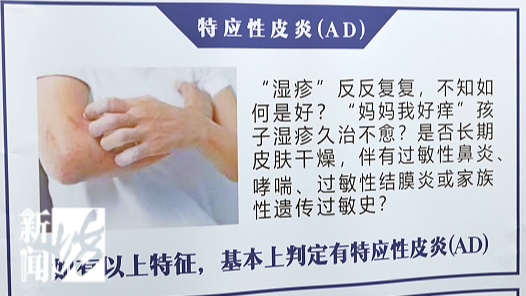 “上海的梅雨季你让我哭!”还要忍几天?身上又黏又痒,有人大腿同时长癣和湿疹… “上海的梅雨季你让我哭!”还要忍几天?身上又黏又痒,有人大腿同时长癣和湿疹…