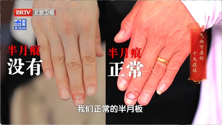 全身“虚”的人，有这10个表现！两杯茶祛湿、解郁、健脾，帮你把气血补回来~