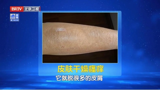 全身“虚”的人，有这10个表现！两杯茶祛湿、解郁、健脾，帮你把气血补回来~
