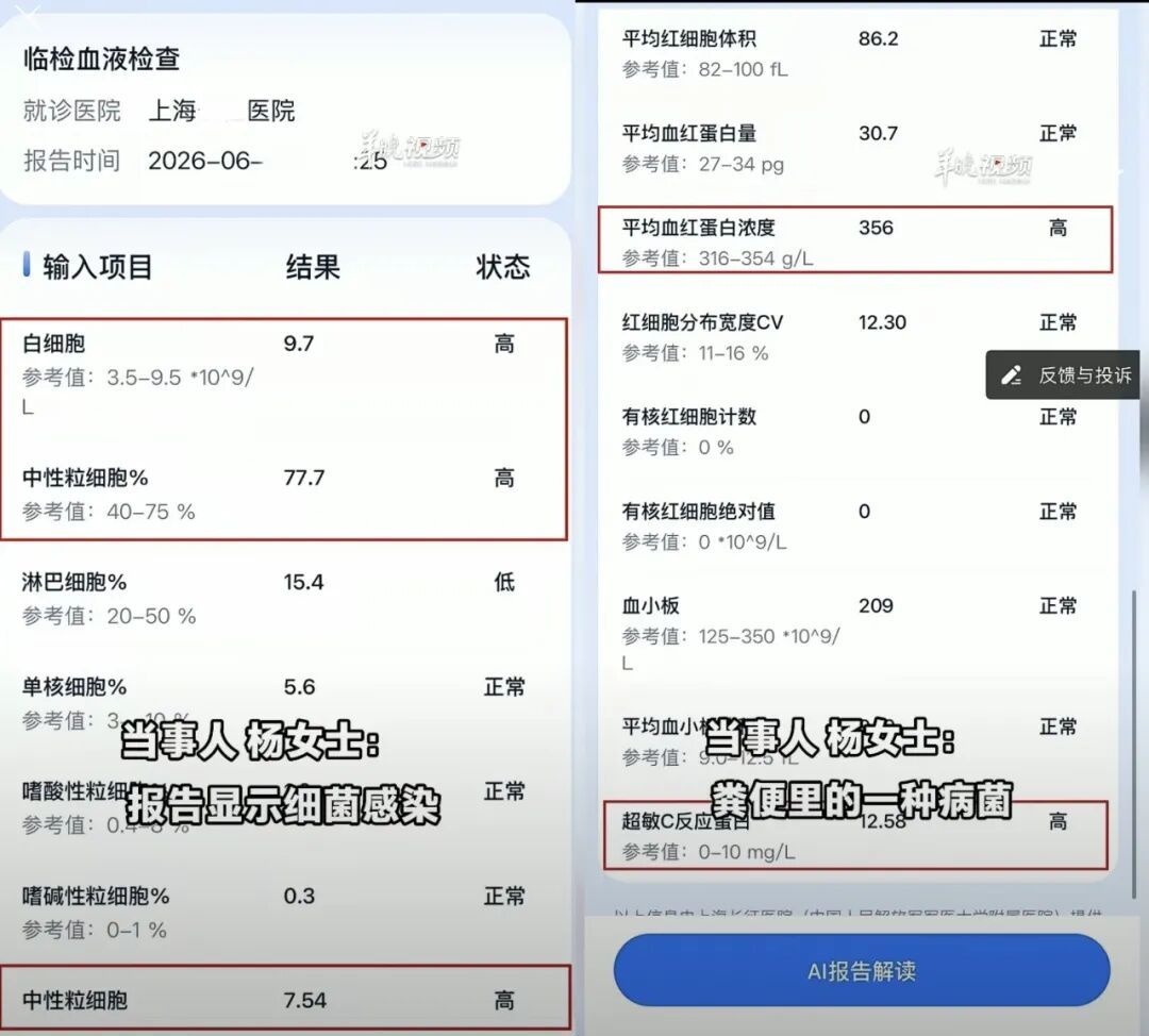 女子上厕所时闻到一股恶臭，当晚扁桃体发炎，医生：大概率是感染粪便里的病菌