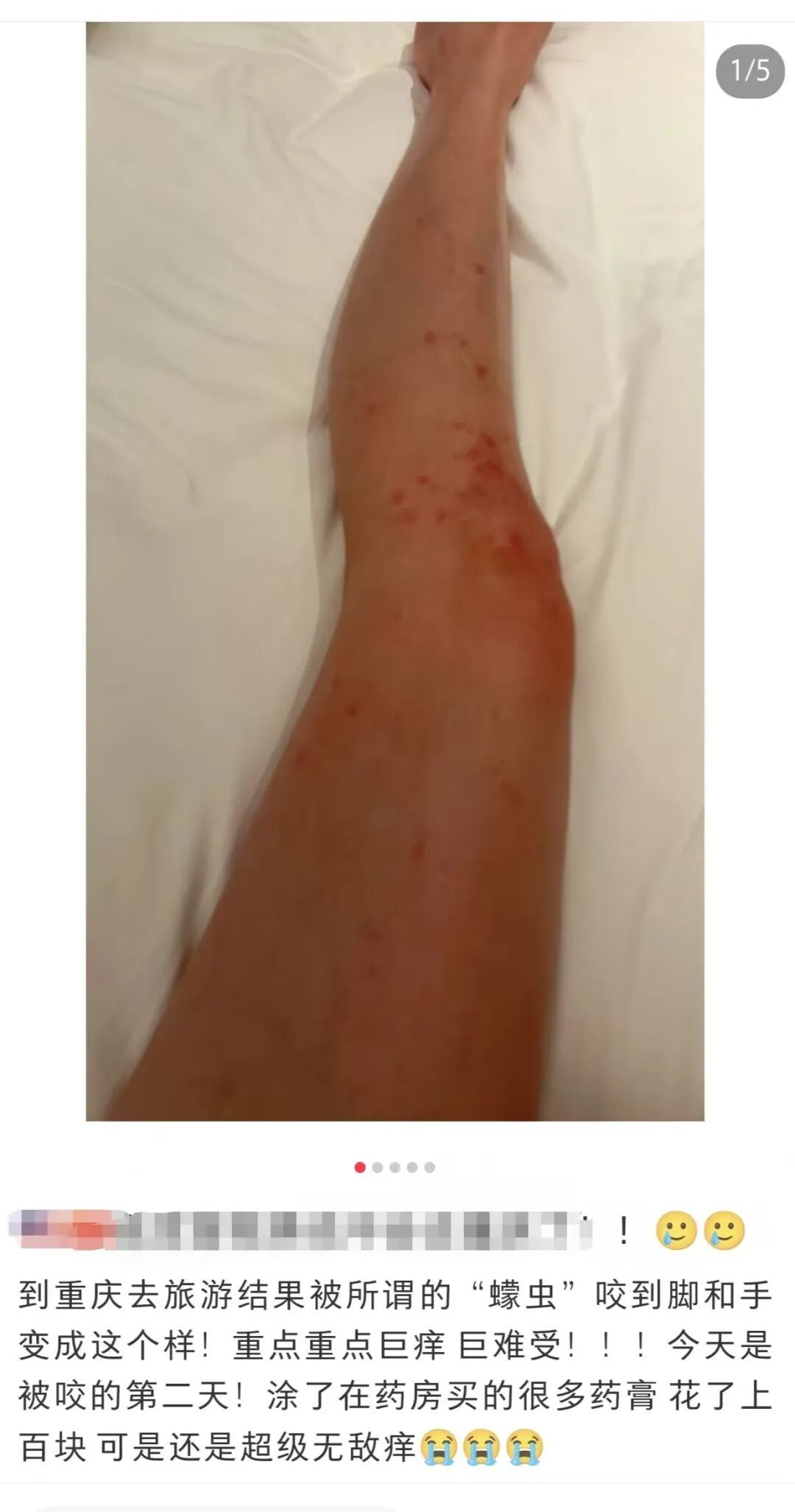 比蚊子更小，更毒！重庆人注意，这种虫子进入活跃期→