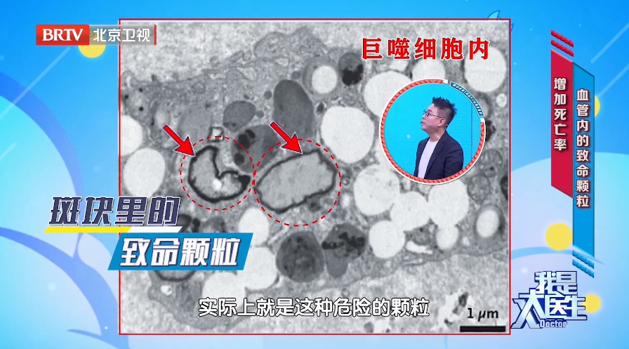 致癌又添新证！你天天吃的它，可能“划伤”肠道、助长肿瘤！“解药”就在菜市场里