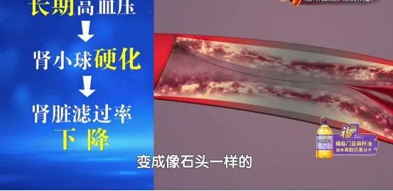 肾好不好，只要一个动作就知道，还有3个“护肾法宝”，赶紧学起来