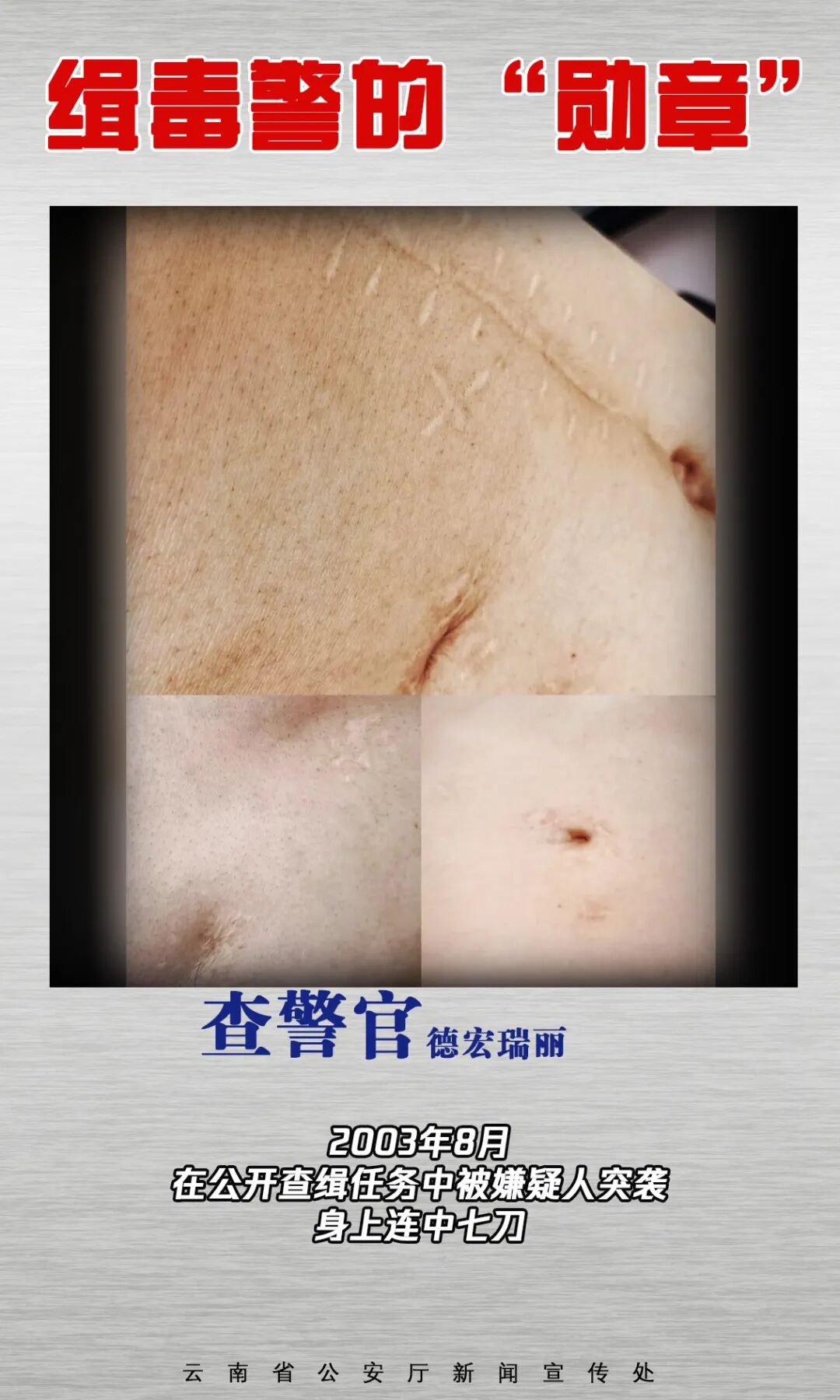 云南缉毒警的“勋章”，是满身伤疤→