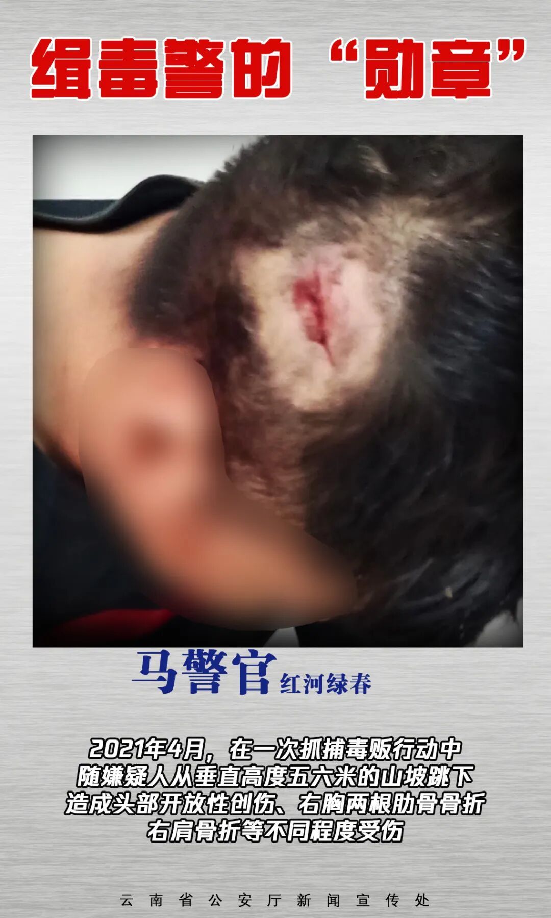 云南缉毒警的“勋章”，是满身伤疤→