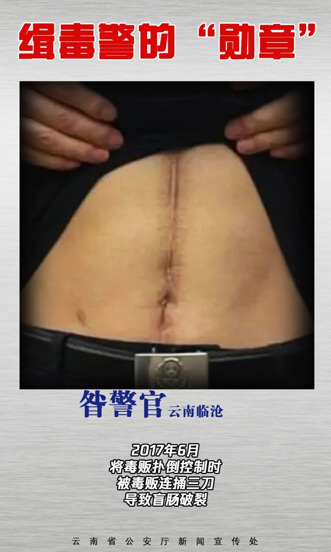 云南缉毒警的“勋章”，是满身伤疤→