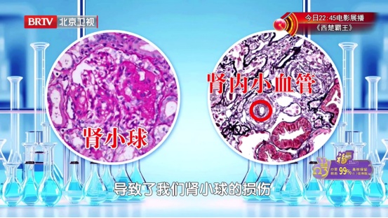 肾好不好，只要一个动作就知道，还有3个“护肾法宝”，赶紧学起来