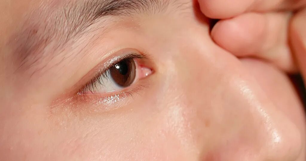 严重可致盲，这4个可能毁掉眼睛的行为有人天天都在做