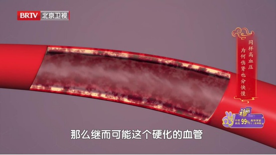 肾好不好，只要一个动作就知道，还有3个“护肾法宝”，赶紧学起来