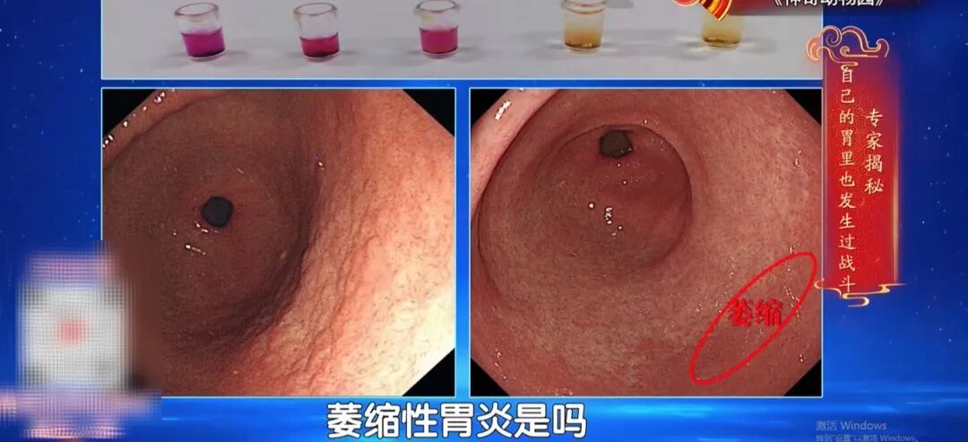 7大高发癌，可以提前拦截，对照这份清单抓紧查，准确还不花冤枉钱