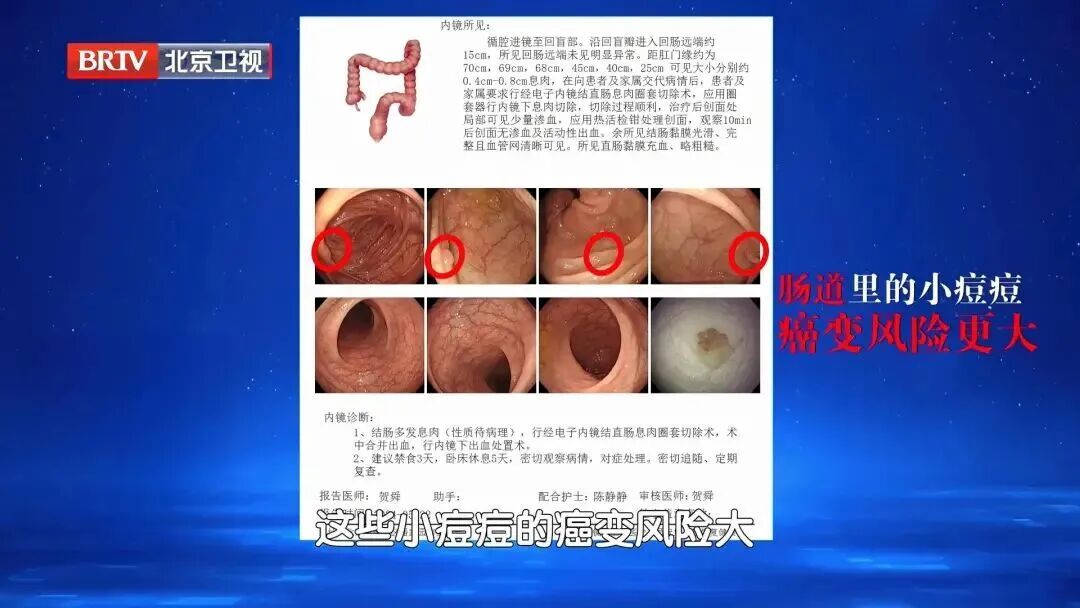 7大高发癌，可以提前拦截，对照这份清单抓紧查，准确还不花冤枉钱