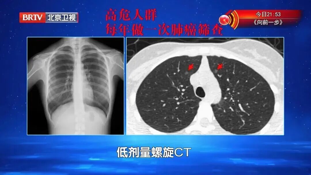 7大高发癌，可以提前拦截，对照这份清单抓紧查，准确还不花冤枉钱