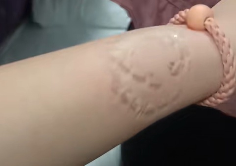 女子火车上被霸座大妈咬伤长疱疹，当事人：怕有传染病，希望得到对方体检报告