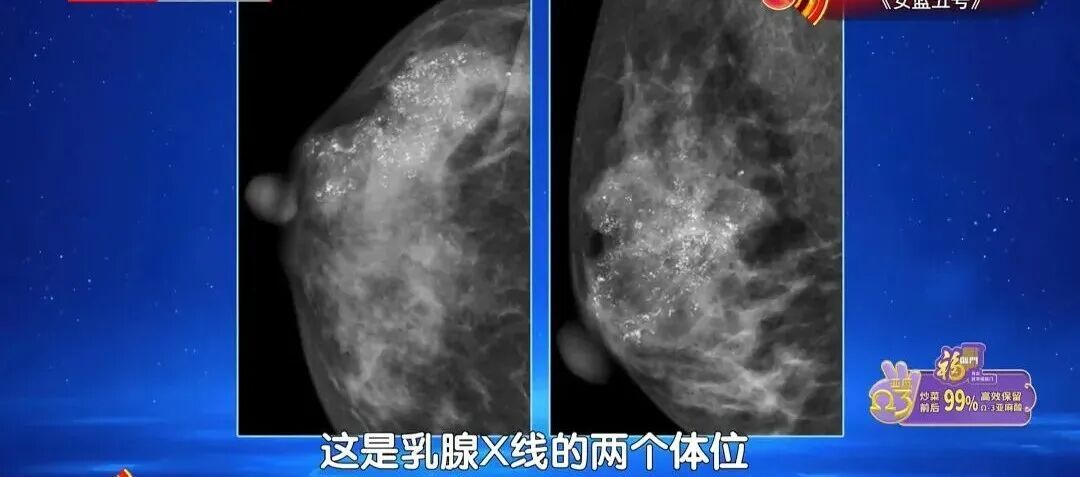 7大高发癌，可以提前拦截，对照这份清单抓紧查，准确还不花冤枉钱