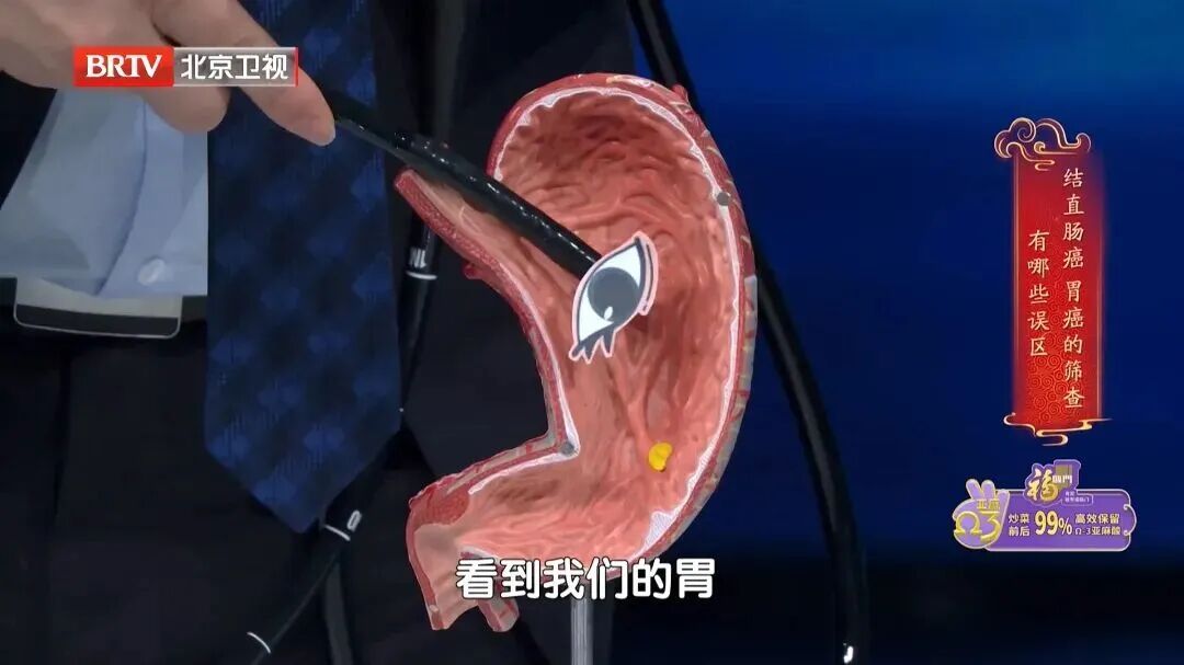 7大高发癌，可以提前拦截，对照这份清单抓紧查，准确还不花冤枉钱