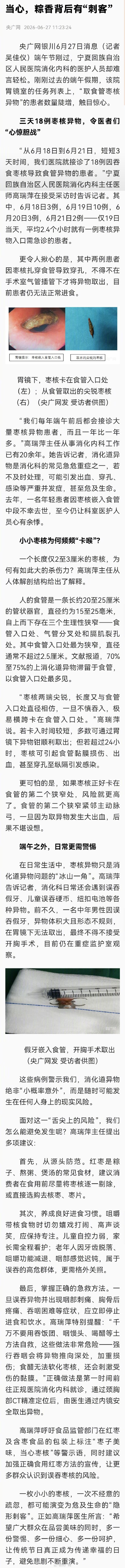 一医院三天接诊18例枣核卡喉患者