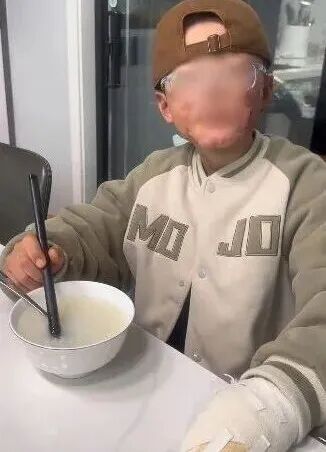 几乎人人都玩过，已有多人受伤！这种街头常见的东西，你家可能也有……