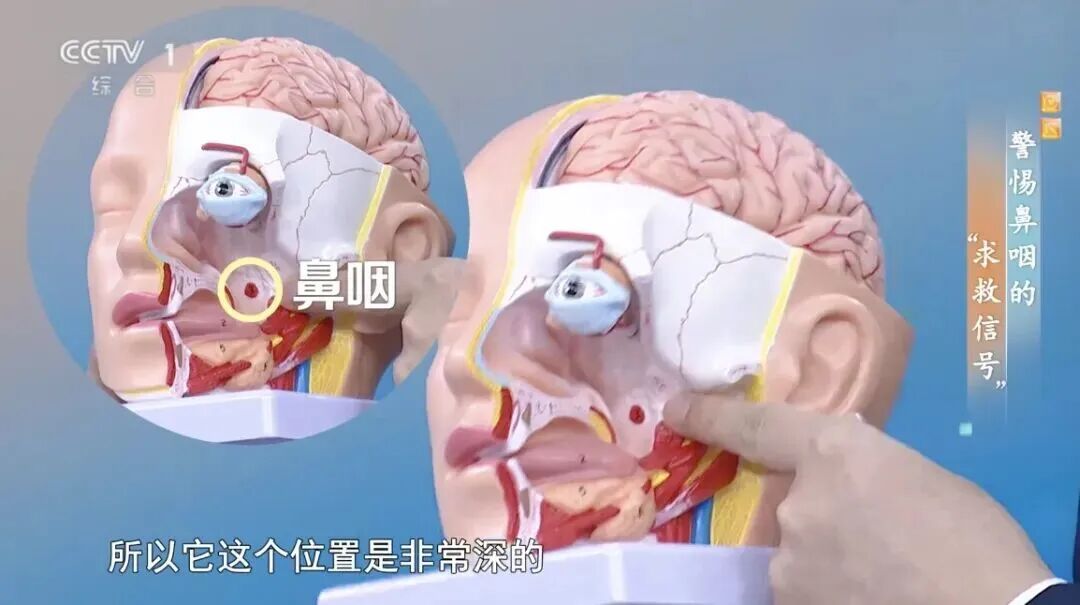 警惕，晨起后有这种现象，可能是癌症信号