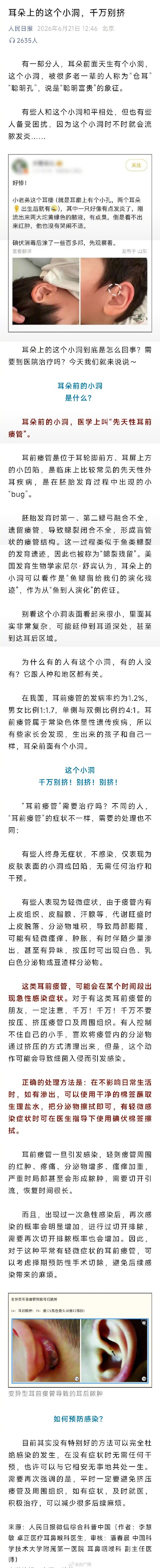 耳朵上的这个小洞千万别挤