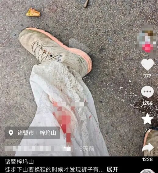 “当时毫无察觉，流血很长时间！”女子爬山被蚂蟥叮咬，出门玩要小心
