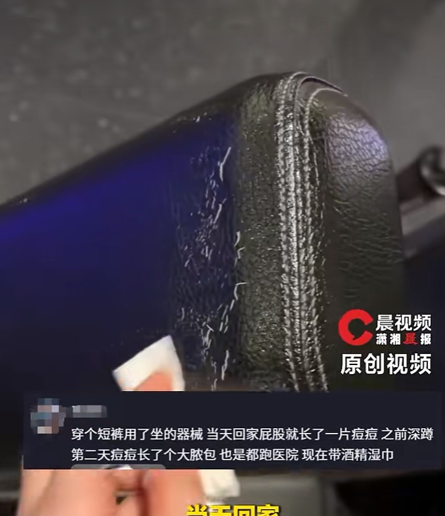 男子健身后脸上长“脚气”，直呼太恐怖！多人曾中招