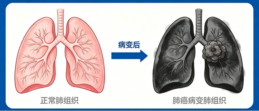 这样做，能够有效防癌！尤其是这四种癌症！