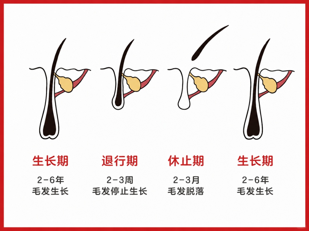 掉头发≠脱发！真正危险的是这几个信号→