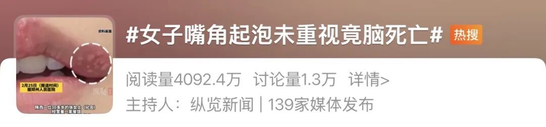女子嘴角长水疱未重视，竟脑死亡，医生提醒：近期高发极易传染，千万别当是上火！