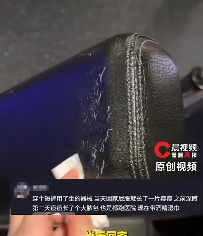 男子健身后用手擦汗，脸上竟感染"脚气"，直呼太恐怖！网友：我也是…