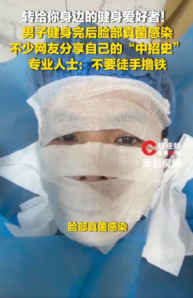 男子健身后用手擦汗，脸上竟感染"脚气"，直呼太恐怖！网友：我也是…