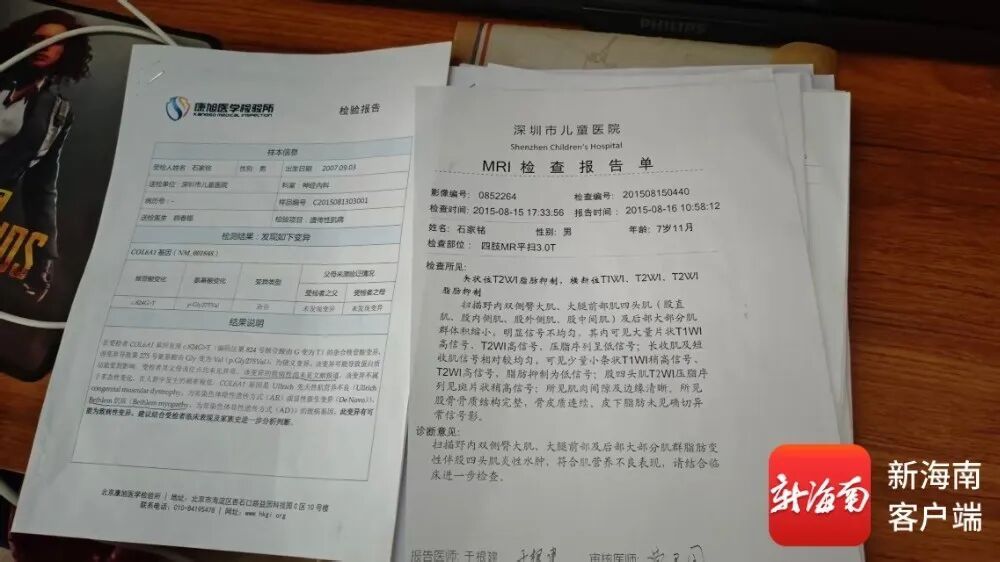 805分！2岁患罕见病、握笔都难的海南少年惊动中科大
