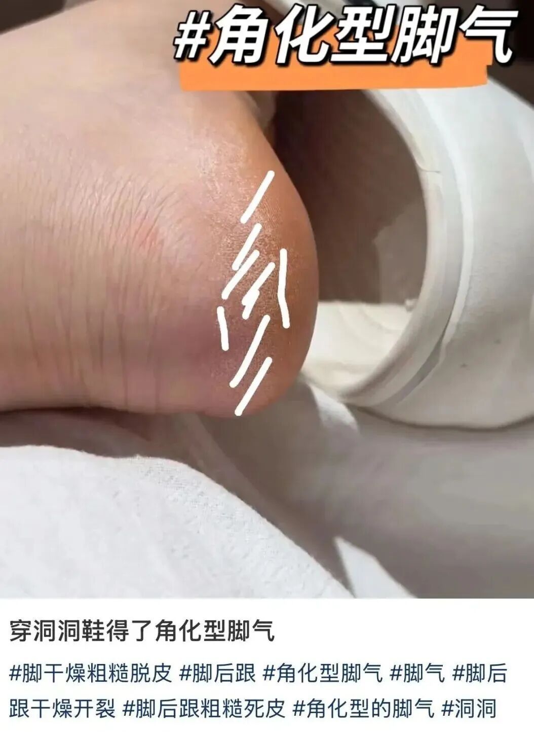 下雨天特别流行!很多上海人天天穿,回家一看"天塌了",医生紧急提醒️ 下雨天特别流行!很多上海人天天穿,回家一看"天塌了",医生紧急提醒️