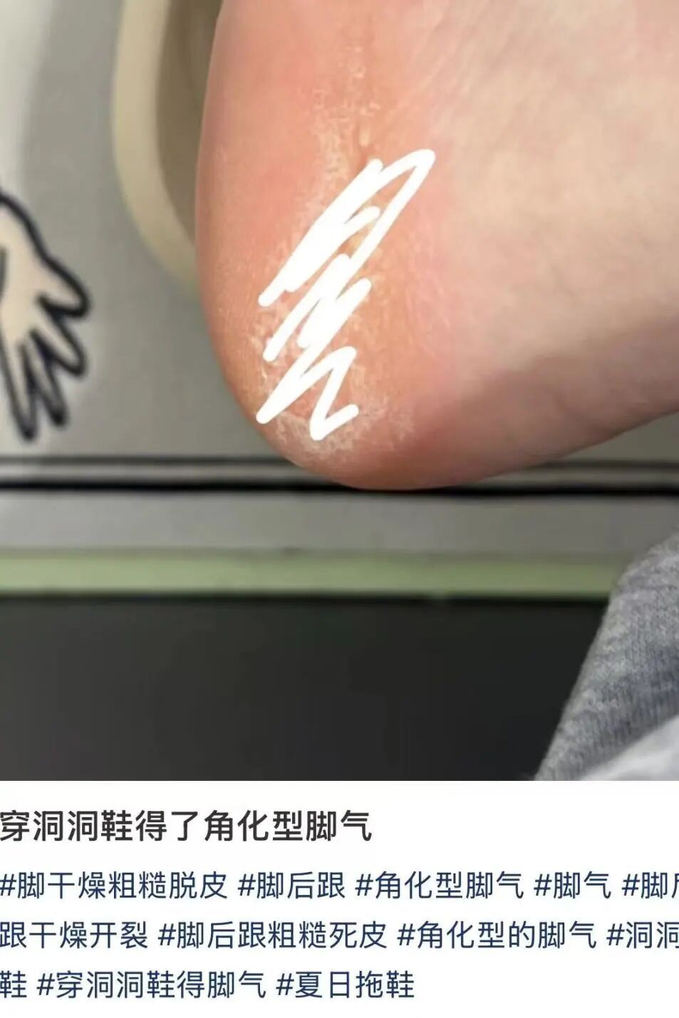 下雨天特别流行!很多人都爱穿,回家一看“天塌了”,医生紧急提醒→ 下雨天特别流行!很多人都爱穿,回家一看“天塌了”,医生紧急提醒→
