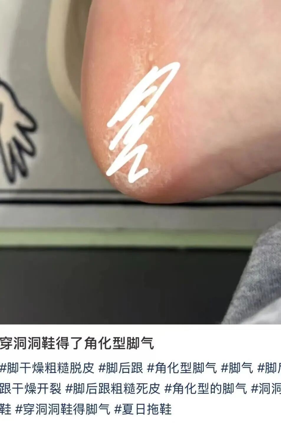 下雨天特别流行!很多上海人天天穿,回家一看"天塌了",医生紧急提醒️ 下雨天特别流行!很多上海人天天穿,回家一看"天塌了",医生紧急提醒️