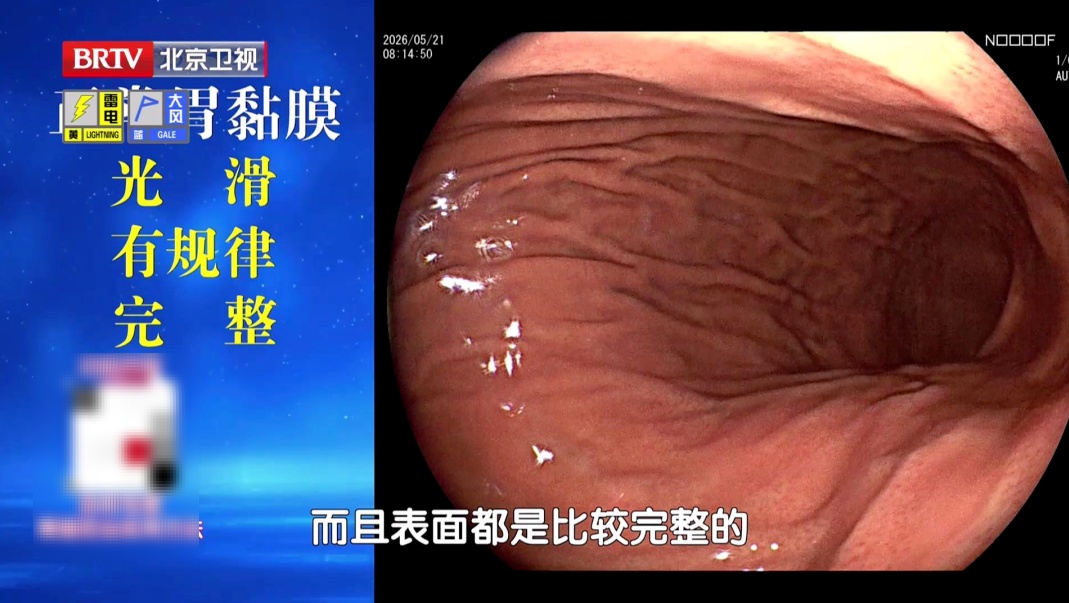 毁掉一个胃,只需要这4个习惯!不想养成癌,建议你今晚开始改 毁掉一个胃,只需要这4个习惯!不想养成癌,建议你今晚开始改