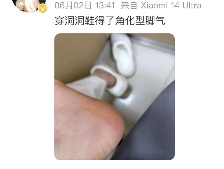 下雨天特别流行!多人穿出脚气,紧急提醒:穿洞洞要注意 下雨天特别流行!多人穿出脚气,紧急提醒:穿洞洞要注意