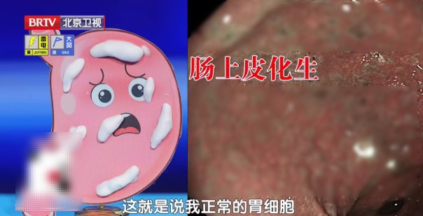 毁掉一个胃,只需要这4个习惯!不想养成癌,建议你今晚开始改 毁掉一个胃,只需要这4个习惯!不想养成癌,建议你今晚开始改