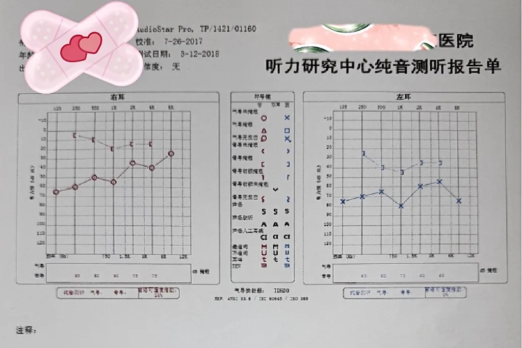 广东28岁女子一出生就患怪病,半边身体长满“苔藓”每次长高发病越狠 广东28岁女子一出生就患怪病,半边身体长满“苔藓”每次长高发病越狠