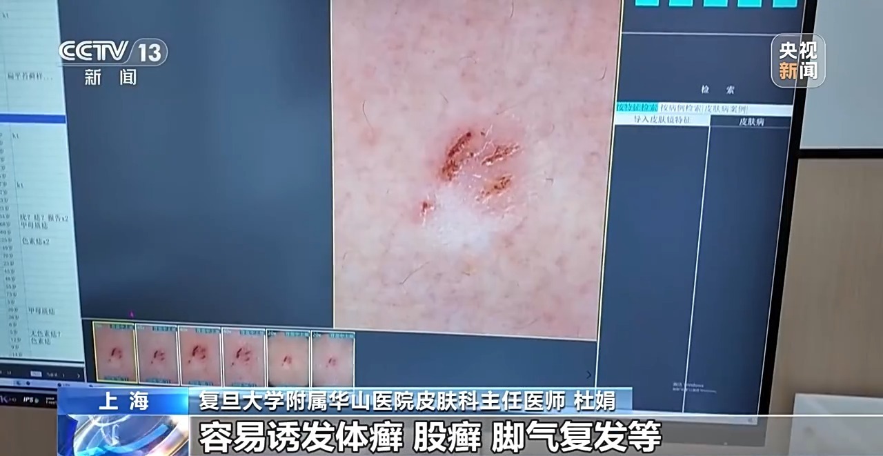 什么是梅雨?梅雨季阴干衣物霉味刺鼻该如何解决?一文了解 什么是梅雨?梅雨季阴干衣物霉味刺鼻该如何解决?一文了解