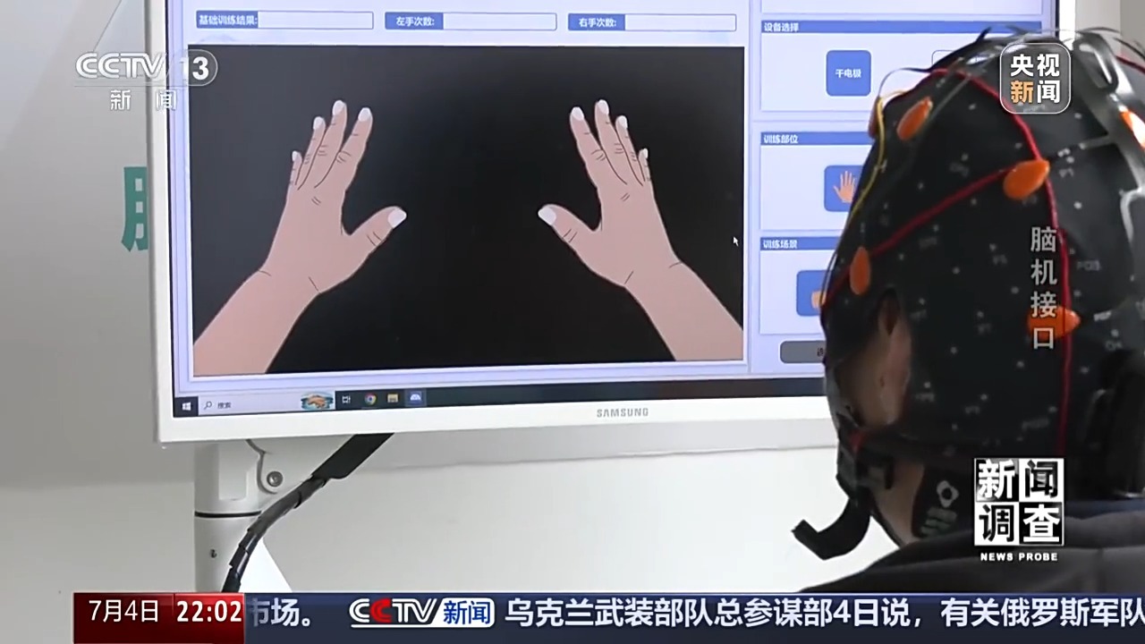 从科幻走向现实 脑机接口技术帮助患者“接”入未来