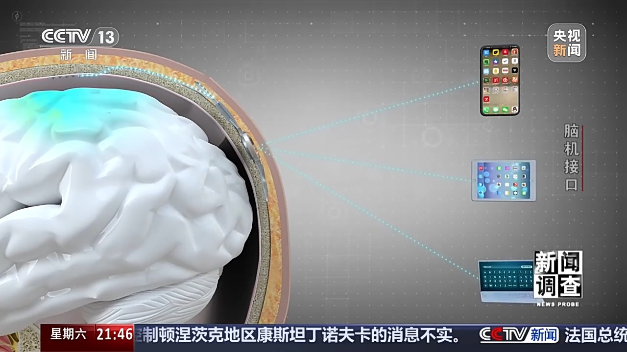 从科幻走向现实 脑机接口技术帮助患者“接”入未来