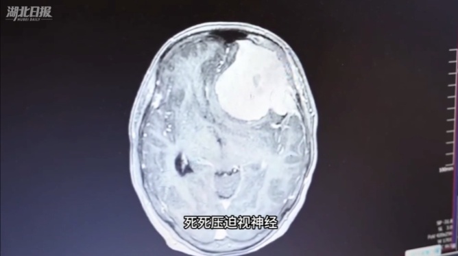 女子倒水老打翻、被锅铲烫没感觉……检查结果惊出冷汗! 女子倒水老打翻、被锅铲烫没感觉……检查结果惊出冷汗!