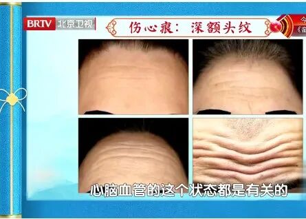 五脏好不好,看脸就知道,5种“危险面相”快自查,每一个都要注意 五脏好不好,看脸就知道,5种“危险面相”快自查,每一个都要注意