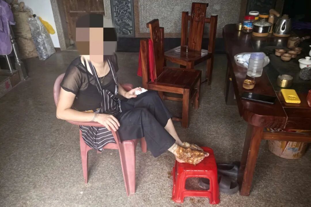 他们因它不同程度受伤!在家使用时千万别大意 他们因它不同程度受伤!在家使用时千万别大意