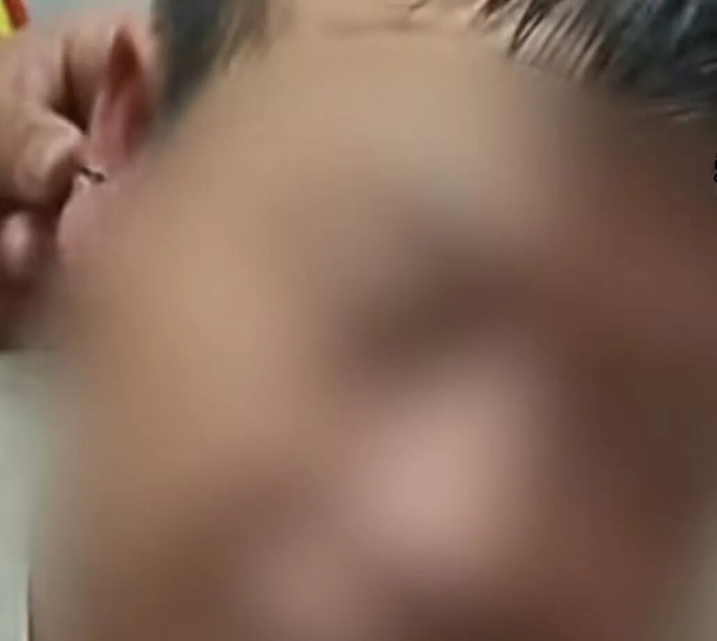 看着都痛!男子夜钓不小心被鱼钩“打耳洞”,不仅惊动医生还惊动了消防员 看着都痛!男子夜钓不小心被鱼钩“打耳洞”,不仅惊动医生还惊动了消防员