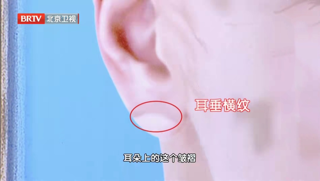 五脏好不好,看脸就知道,5种“危险面相”快自查,每一个都要注意 五脏好不好,看脸就知道,5种“危险面相”快自查,每一个都要注意