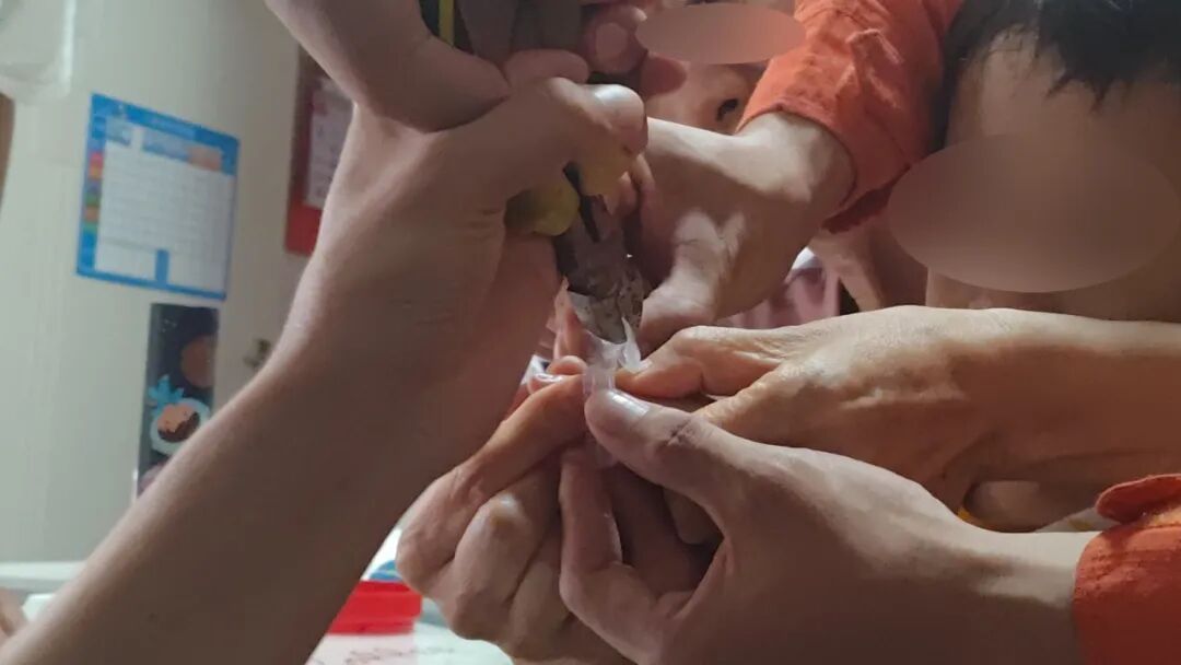 瓶盖“咬住”幼童手指 &nbsp;顺义消防精细救援