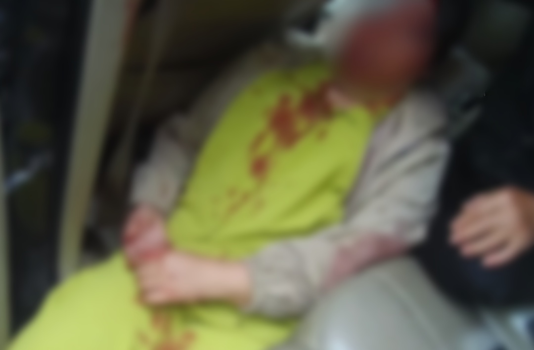 后排乘客头部受猛烈撞击、颈椎骨折,经抢救无效不幸身亡!重要提醒→ 后排乘客头部受猛烈撞击、颈椎骨折,经抢救无效不幸身亡!重要提醒→