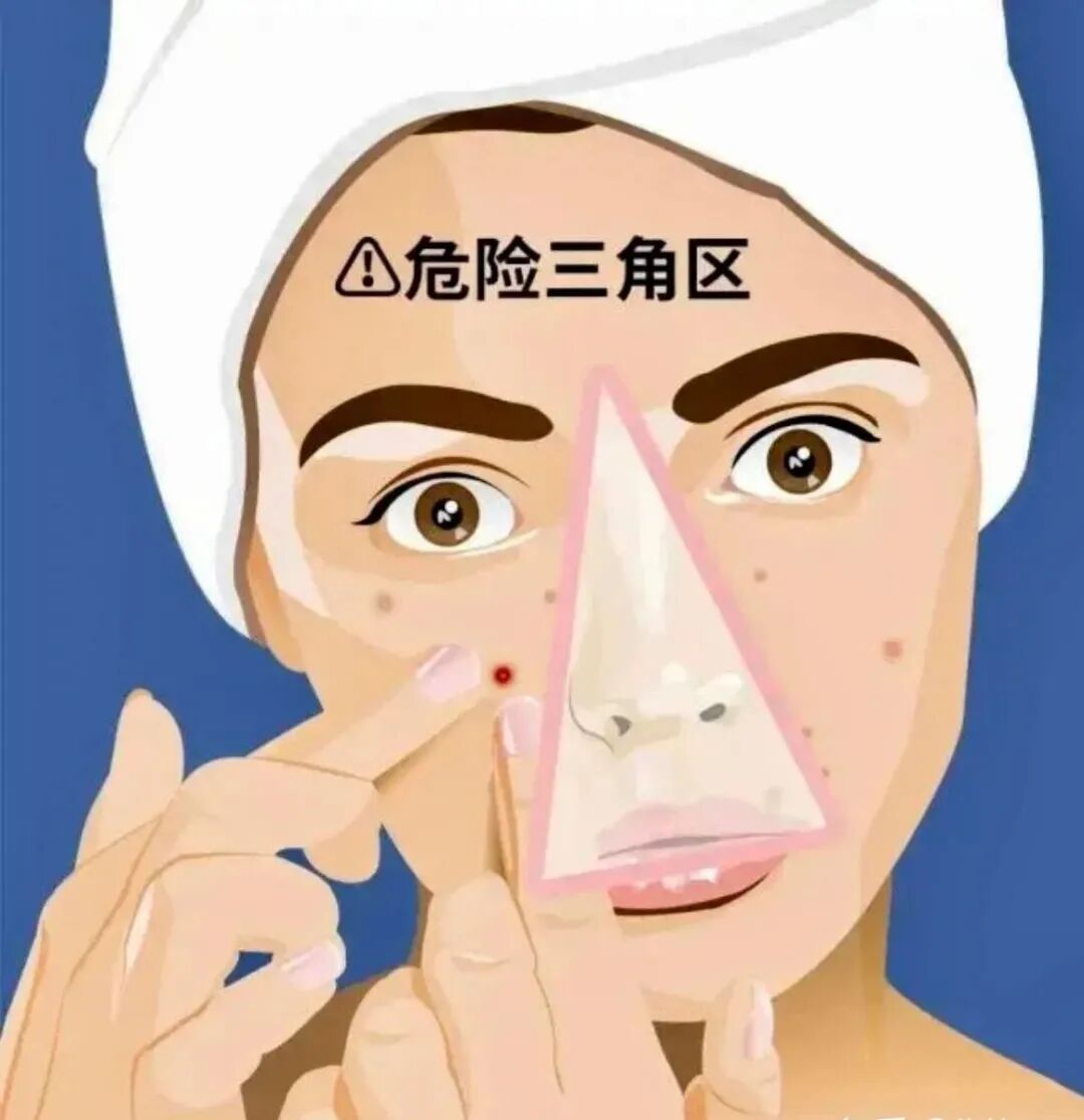 面部“小疙瘩”,千万别乱挤! 面部“小疙瘩”,千万别乱挤!